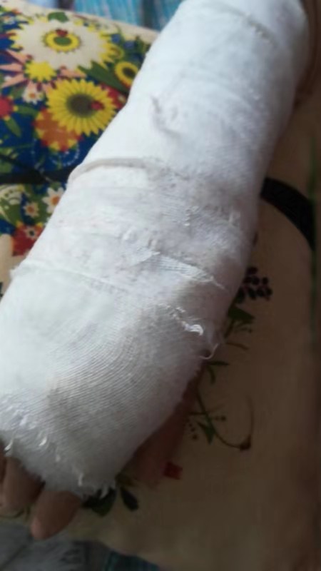 顧客因地面污物滑倒摔成骨折，安陽沃爾瑪推卸責(zé)任良心何在