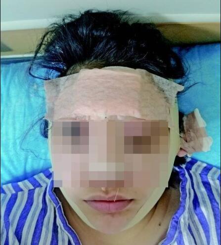 想當“網紅”拿高薪 少女陷貸款整容圈套