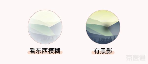 同仁醫(yī)生:4個(gè)眼科測(cè)試圖,1分鐘測(cè)眼睛是否健康！