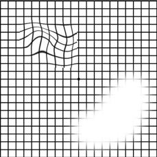 同仁醫(yī)生:4個(gè)眼科測(cè)試圖,1分鐘測(cè)眼睛是否健康！