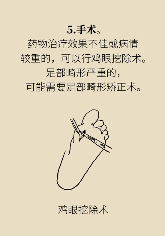 長(zhǎng)了雞眼和老繭怎么辦？這份防治指南請(qǐng)收好