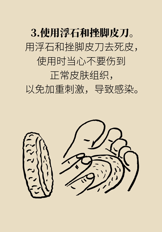 長(zhǎng)了雞眼和老繭怎么辦？這份防治指南請(qǐng)收好