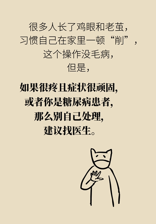 長(zhǎng)了雞眼和老繭怎么辦？這份防治指南請(qǐng)收好