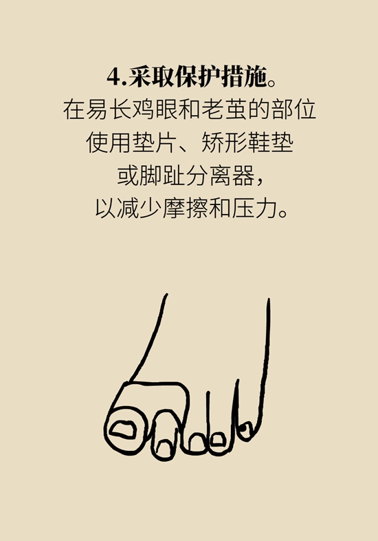 長(zhǎng)了雞眼和老繭怎么辦？這份防治指南請(qǐng)收好