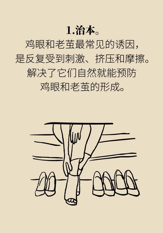 長(zhǎng)了雞眼和老繭怎么辦？這份防治指南請(qǐng)收好