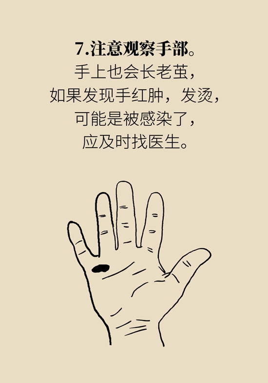 長(zhǎng)了雞眼和老繭怎么辦？這份防治指南請(qǐng)收好