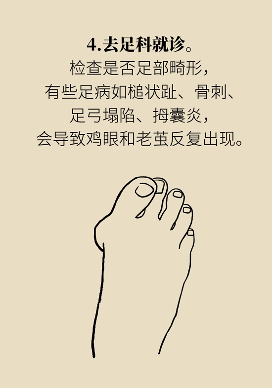 長(zhǎng)了雞眼和老繭怎么辦？這份防治指南請(qǐng)收好