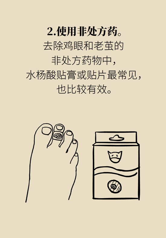 長(zhǎng)了雞眼和老繭怎么辦？這份防治指南請(qǐng)收好
