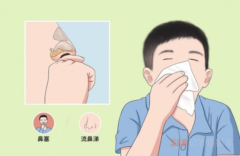 打噴嚏、流鼻涕、鼻塞、呼吸困難、眼睛腫、耳朵癢——原來還有這樣出奇的療愈方法