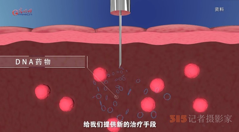 宮頸癌消滅戰(zhàn)：如何減少“梅艷芳式悲劇”？